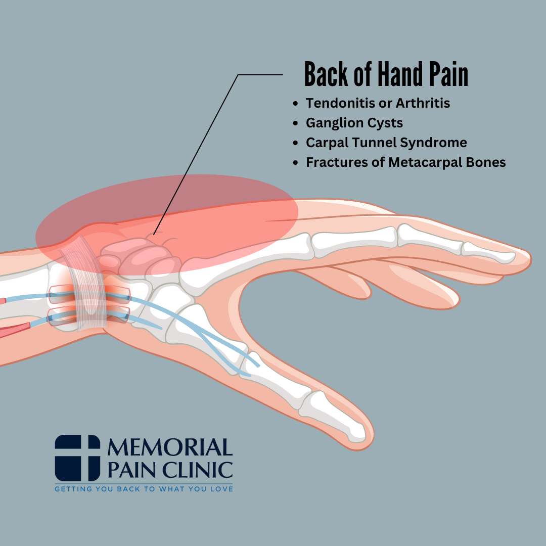 Back of hand pain
