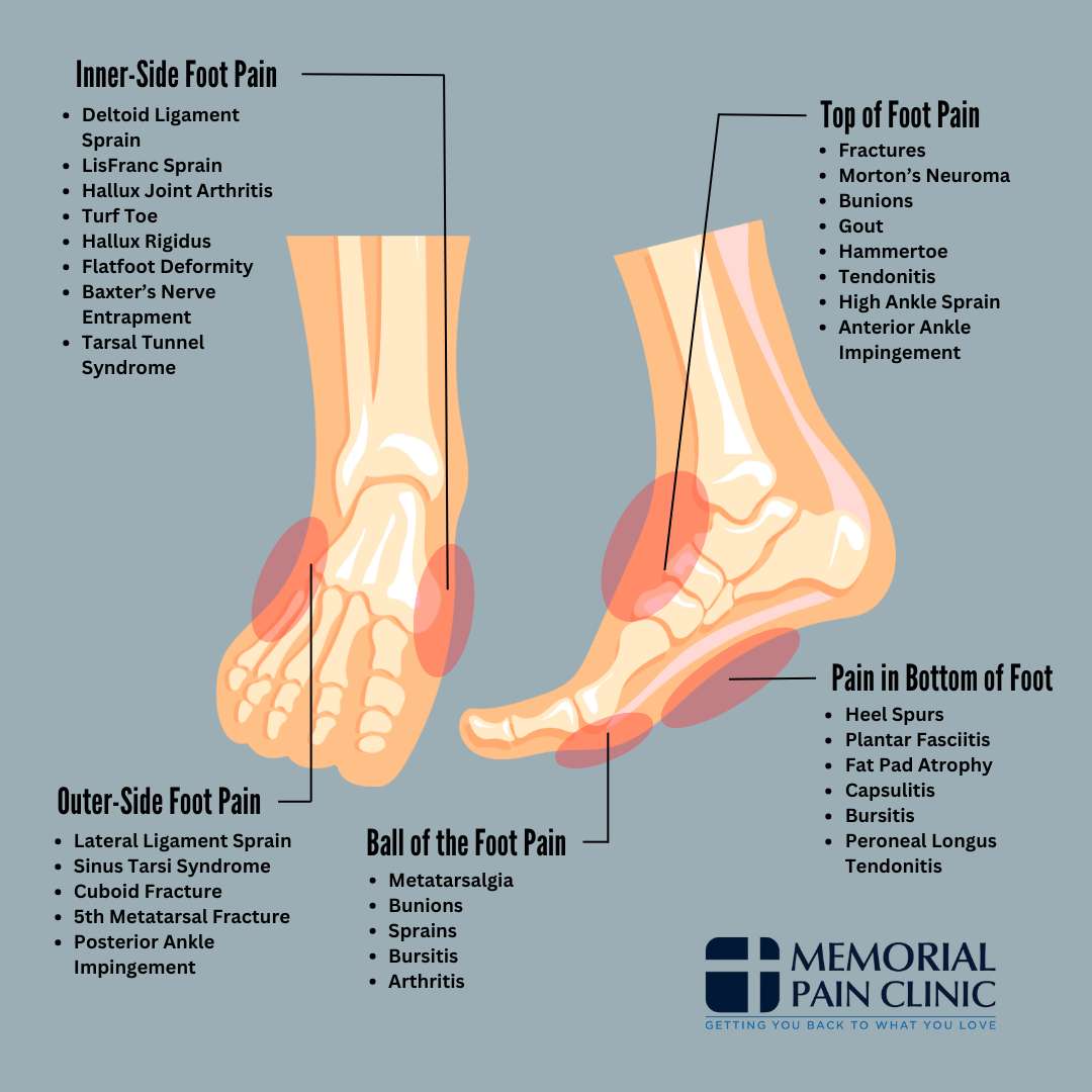 Foot Pain Chart Common Foot Problems Memorial Pain Clinic Foot Pain Chart Common Foot Problems Memorial Pain Clinic