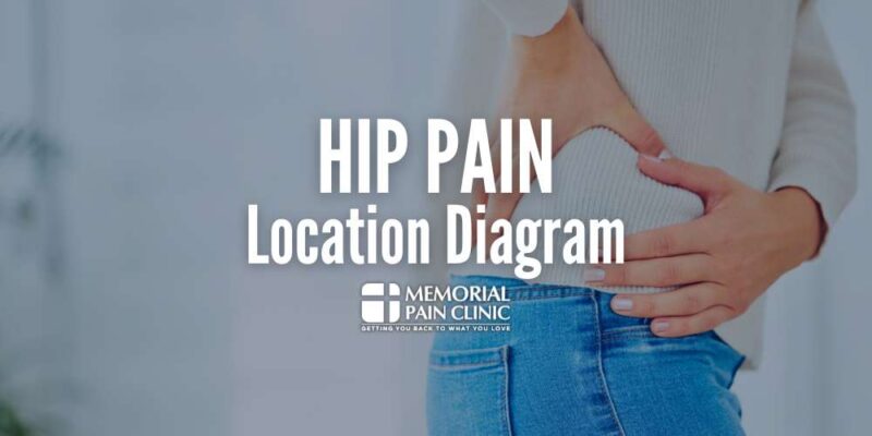 Hip Pain Location Diagram