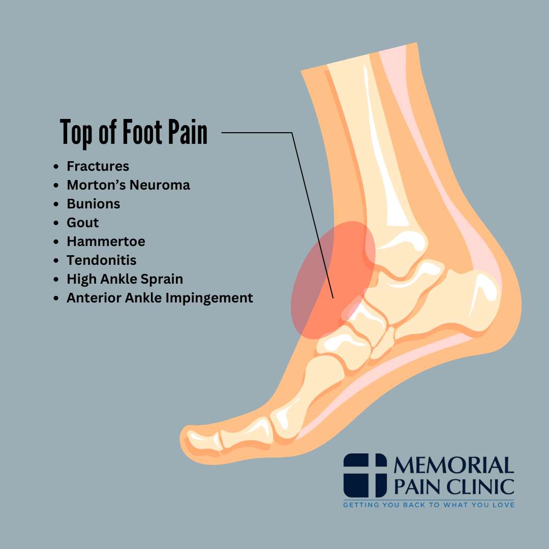 Top of foot pain