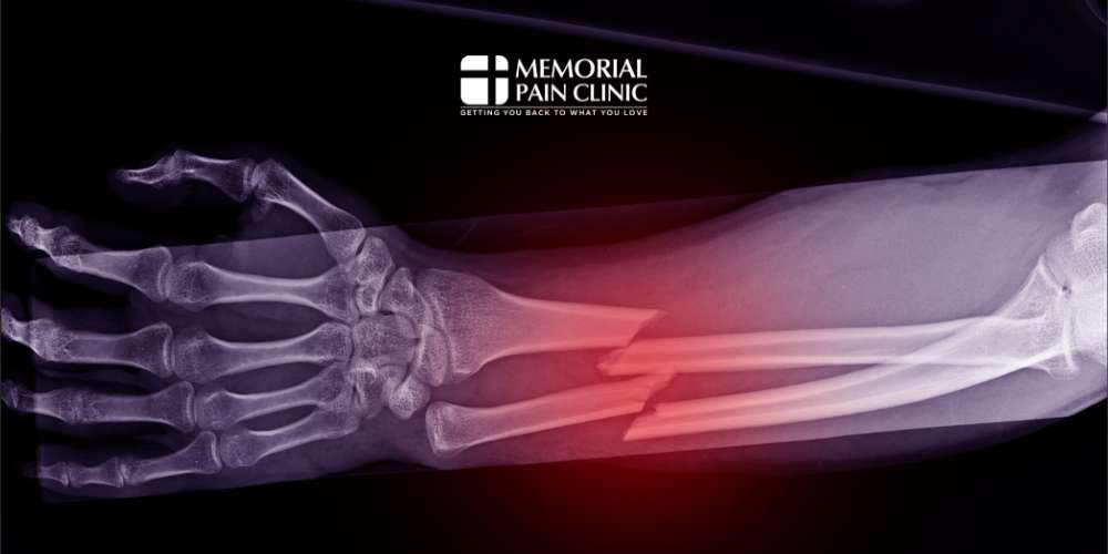 nociceptive pain examples