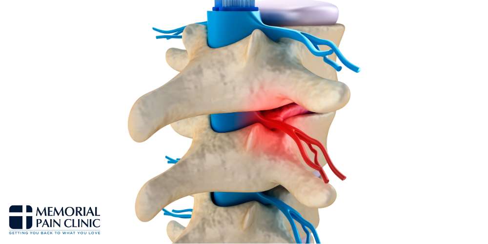 spinal cord stimulation tulsa ok